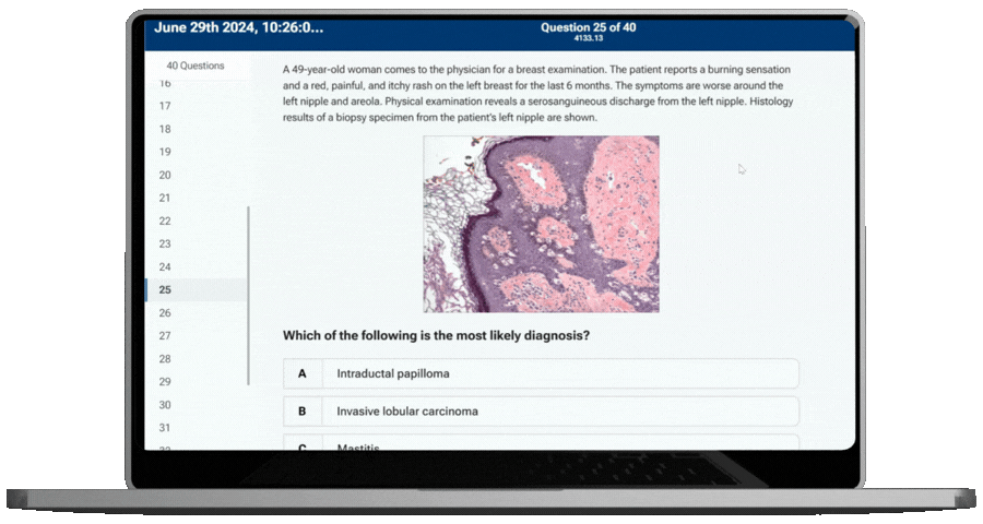 Qmax Questions