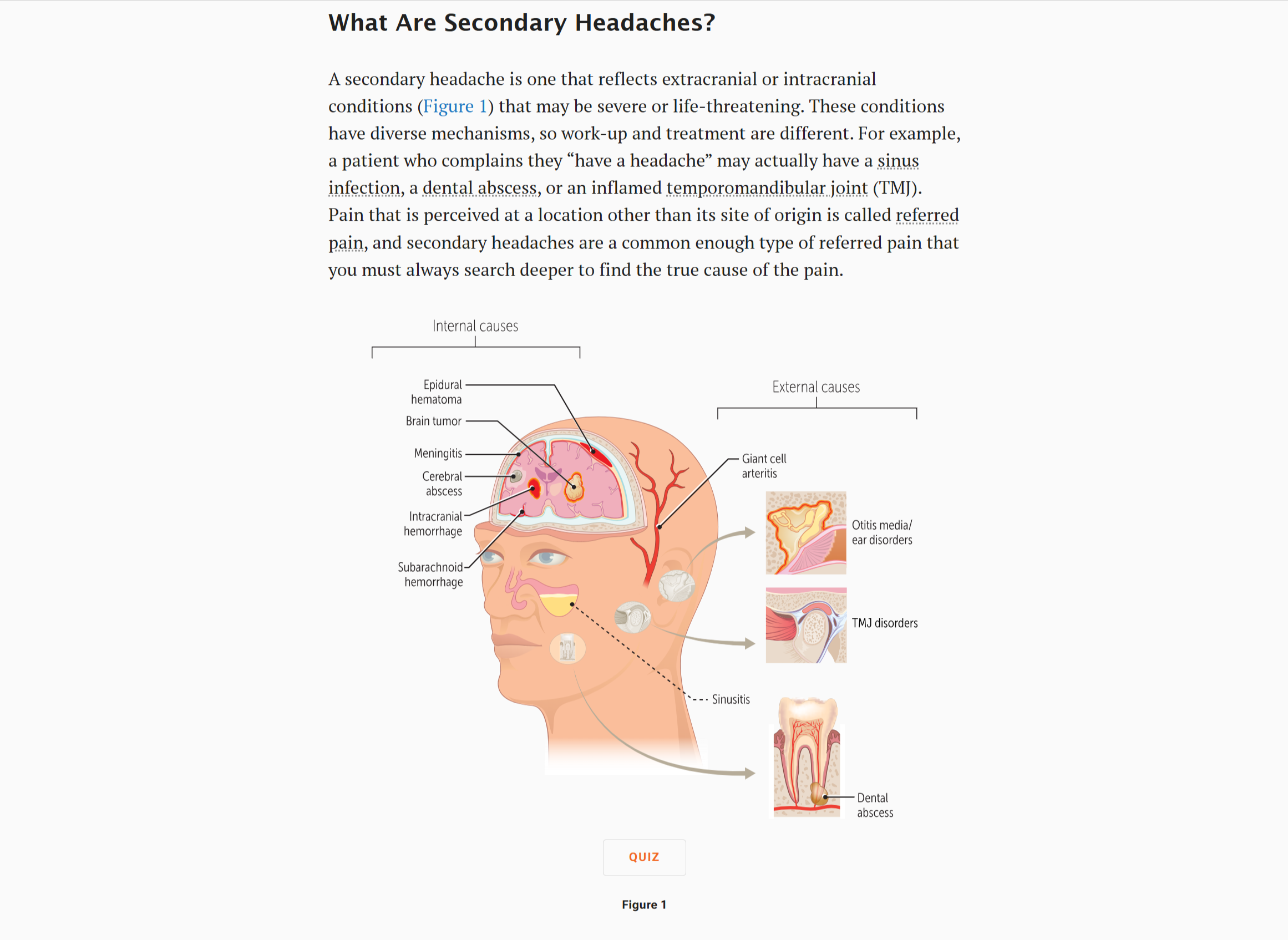 <span class="tour-num">02</span><span class="tour-title">Learn the concept</span><p class="tour-desc">Clear-language explanation with interactive images and diagrams, plus clinical correlations showing where the concept turns up in practice. Most Bricks take under 20 minutes.</p>